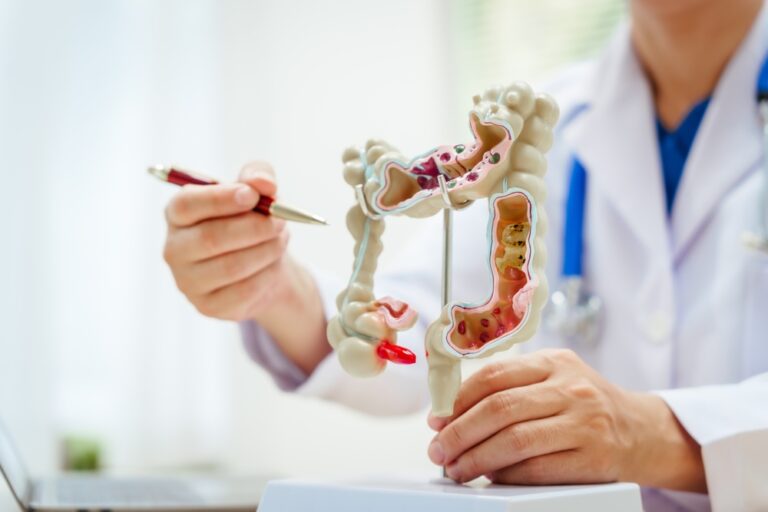 ADH-Colitis and Flareups triggers